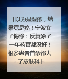 以为是湿疹，结果竟是癌！宁波女子悔惨：反复涂了一年药膏都没好！很多患者首诊都去了皮肤科